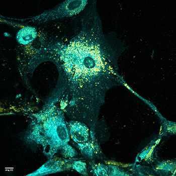 2021 photo contest Understanding Cholesterol Imbalance